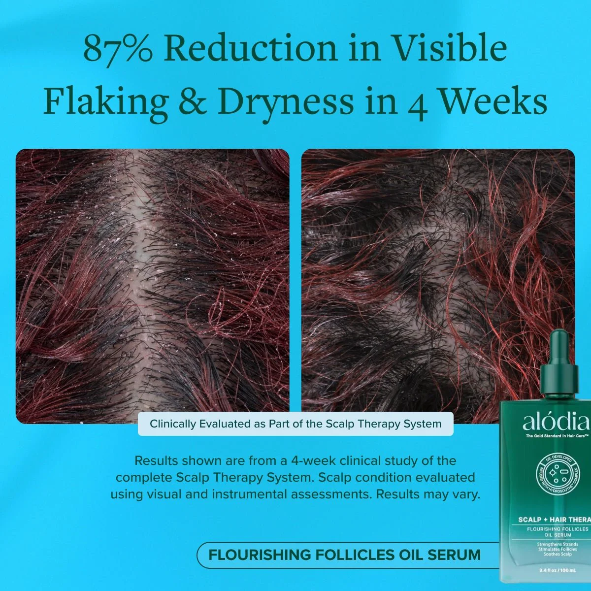 Flourishing Follicles Oil Serum - Image 6