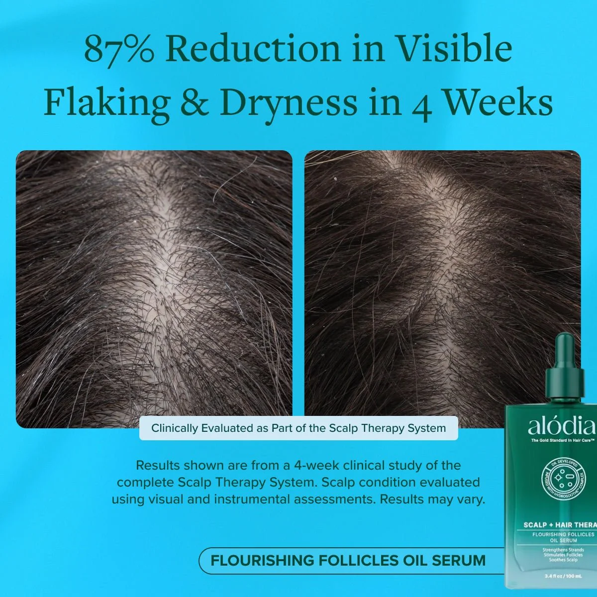 Flourishing Follicles Oil Serum - Image 7