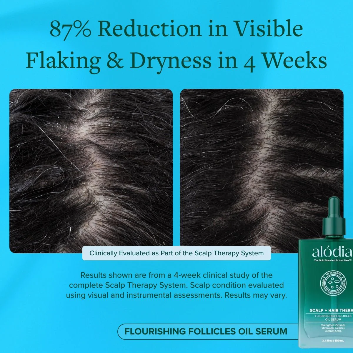 Flourishing Follicles Oil Serum - Image 8