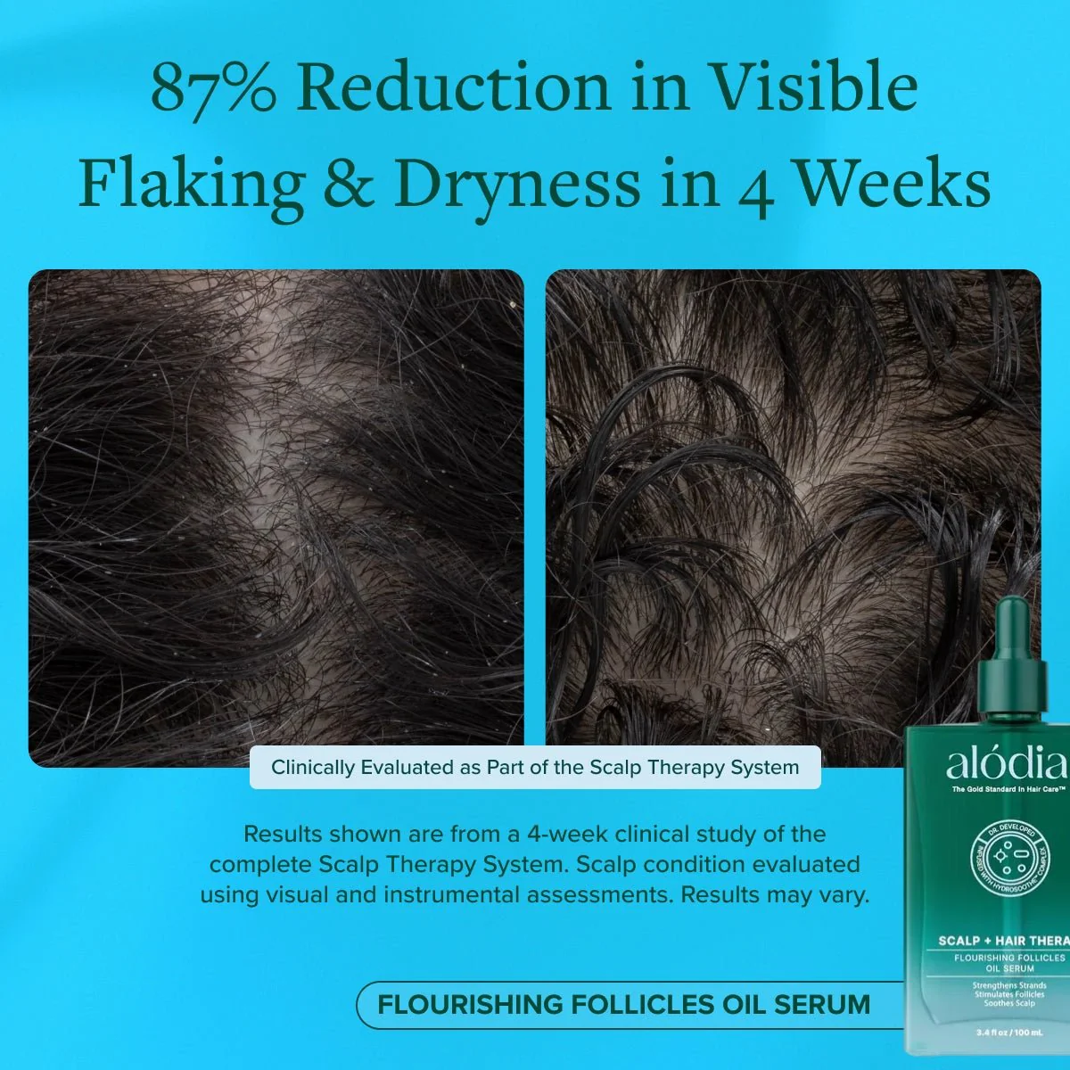 Flourishing Follicles Oil Serum - Image 9