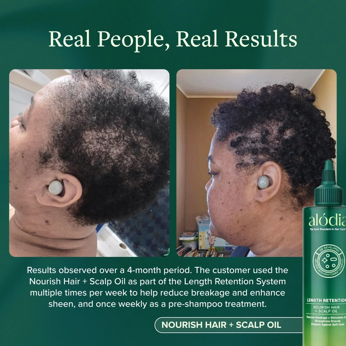 Nourish Hair + Scalp Oil - Image 6