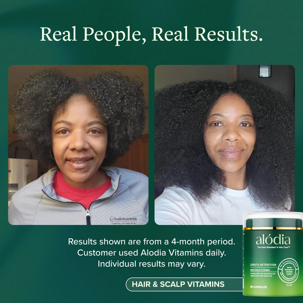 Hair & Scalp Vitamins - Image 10