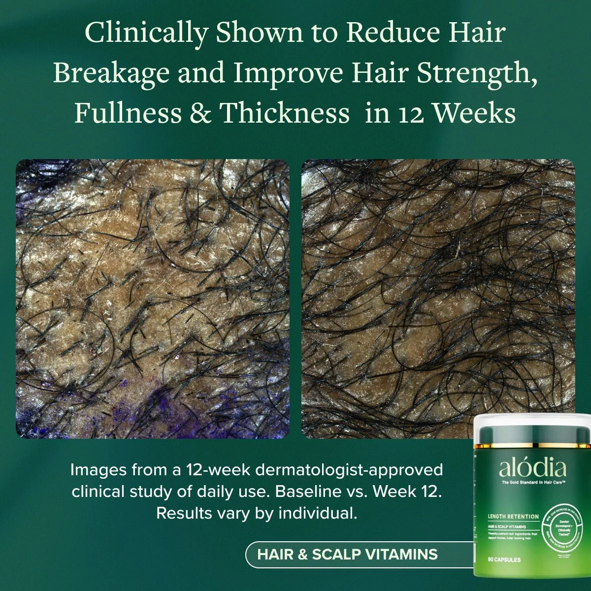 Hair & Scalp Vitamins - Image 6