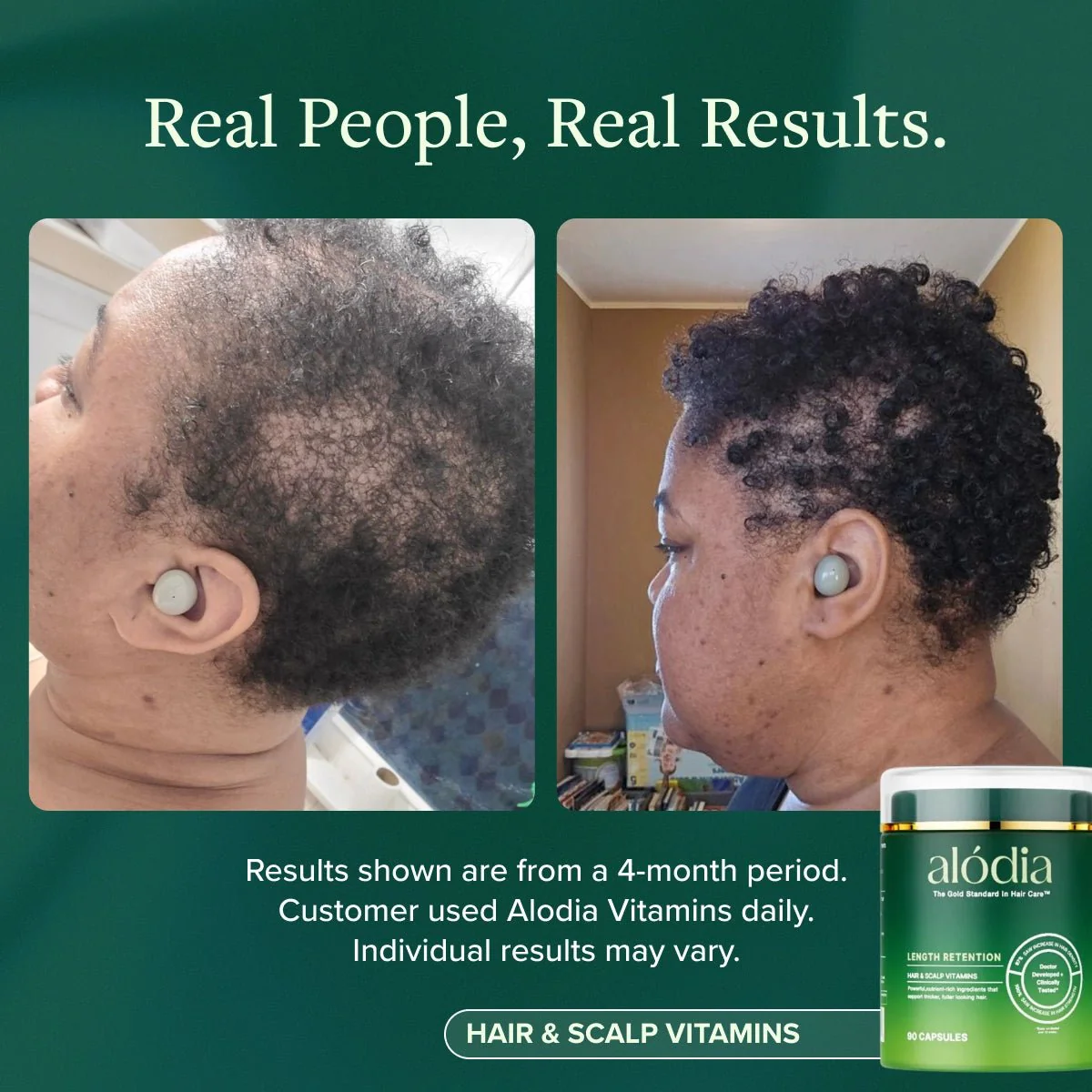 Hair & Scalp Vitamins - Image 7