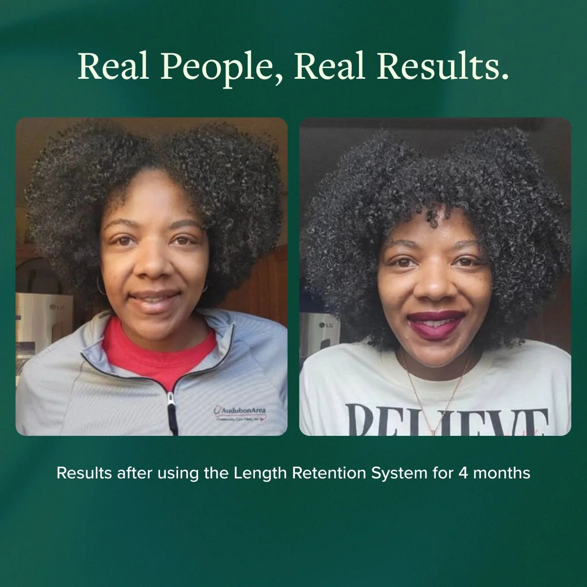 Length Retention System - Image 10