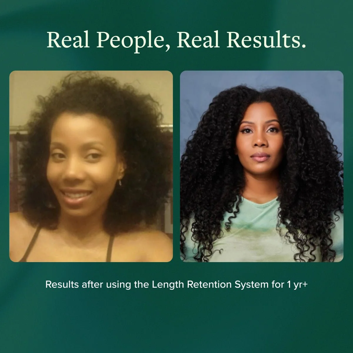 Length Retention System - Image 11