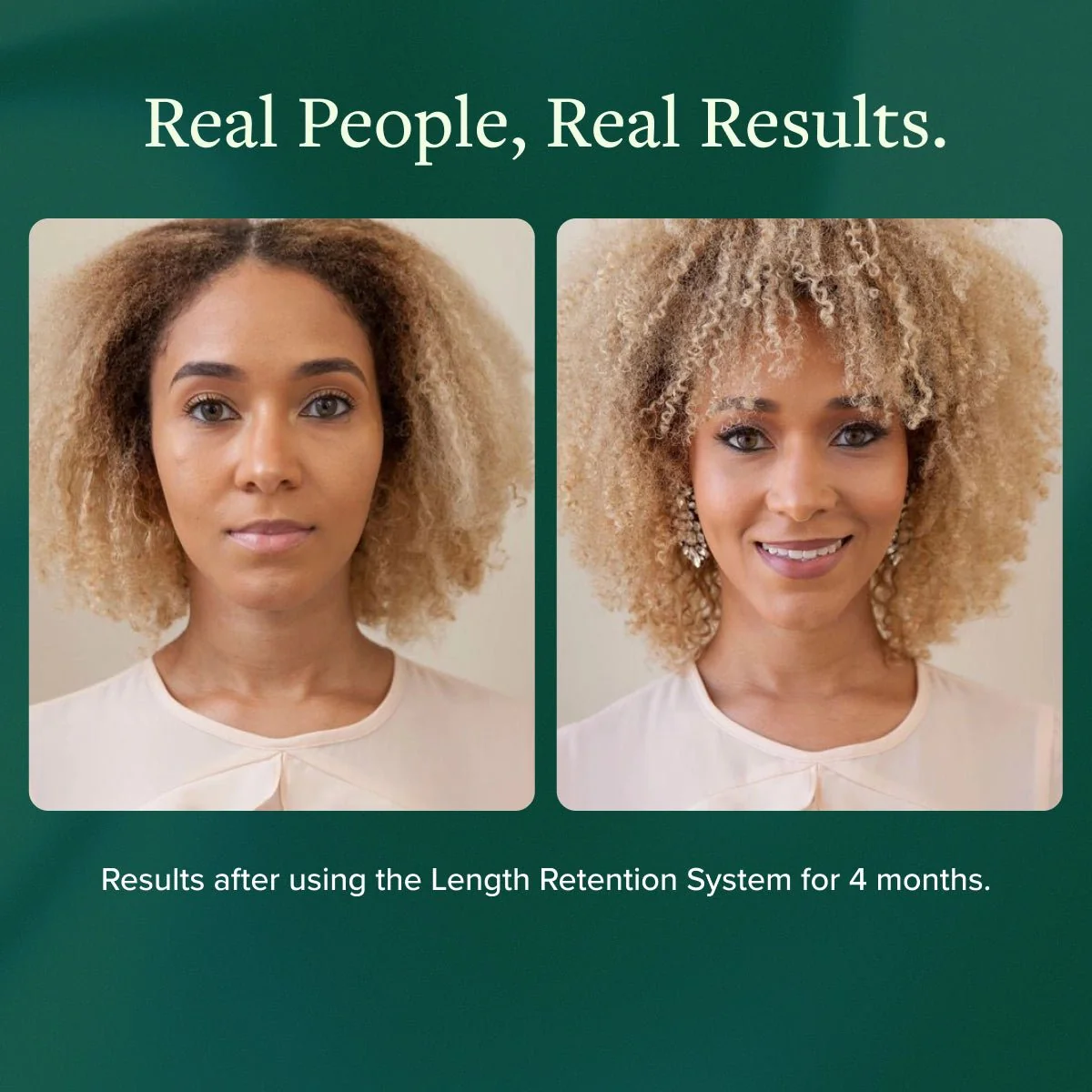 Length Retention System - Image 6