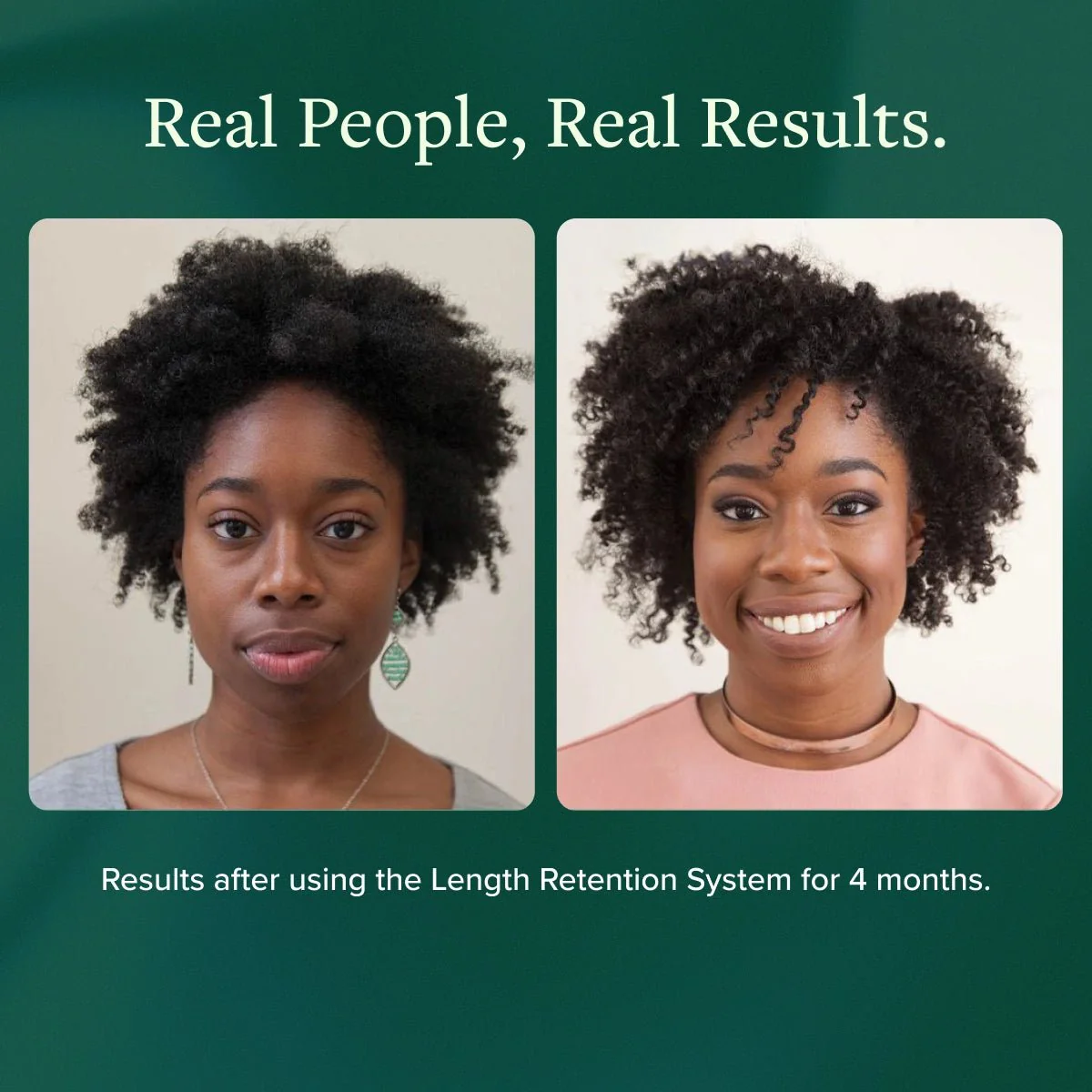 Length Retention System - Image 7