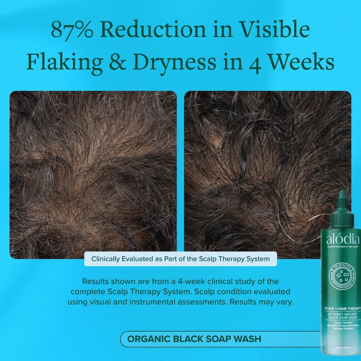 Nutrient Infused Organic Black Soap Wash - Image 5