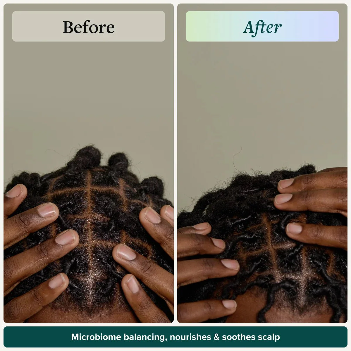 Scalp Therapy System - Image 4